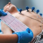 Quick EKG Practice Quiz: Perfect for On-the-Go Learning